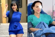 Maribel Guardia sorprende al aparecer con un parche en el ojo