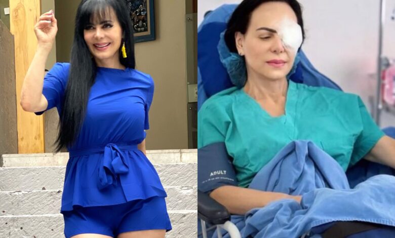 Maribel Guardia sorprende al aparecer con un parche en el ojo